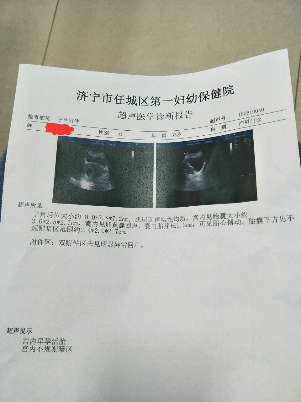 不规则暗区好害怕，有知道的吗？