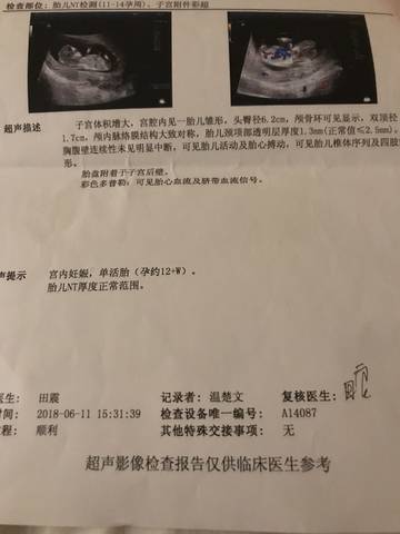 journal_insert_pic_1032712543