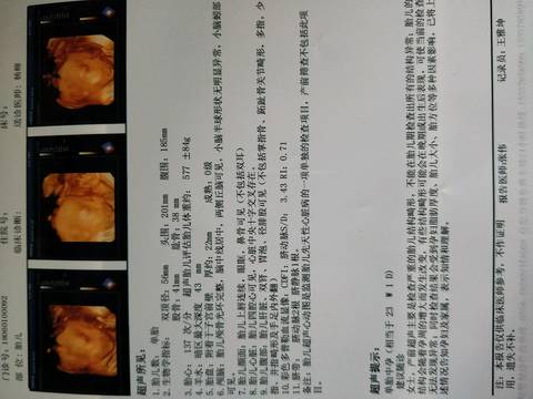 journal_insert_pic_1032386594