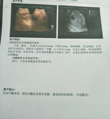 journal_insert_pic_1032390534