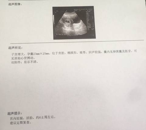 journal_insert_pic_1033042999