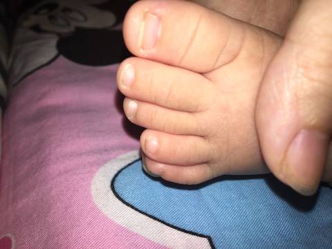 宝宝脚趾头不齐的图片图片