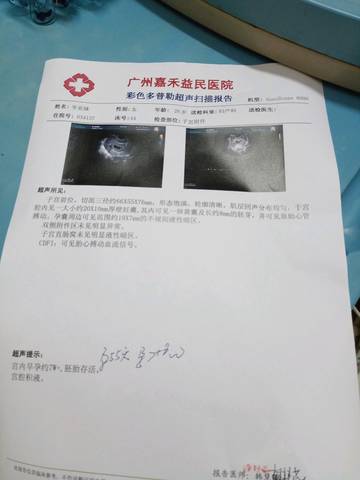 journal_insert_pic_1034542531
