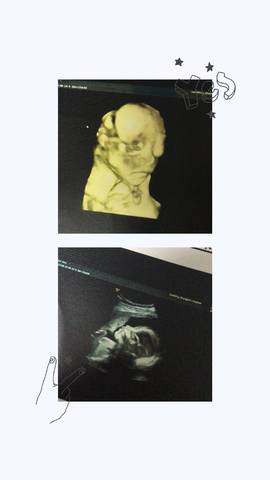 journal_insert_pic_1034792734