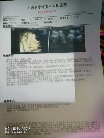 journal_insert_pic_1034502748