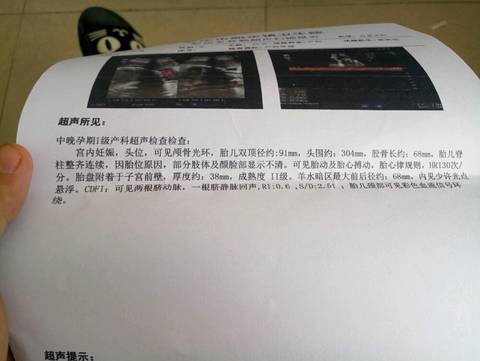 journal_insert_pic_1036311329