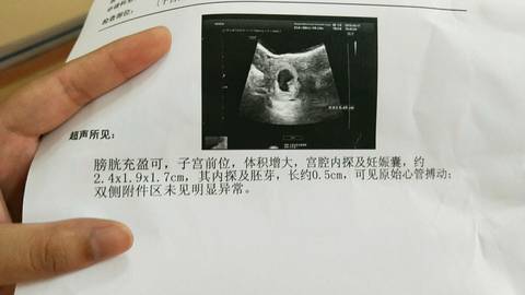 journal_insert_pic_1036467691