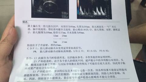 journal_insert_pic_1036309216