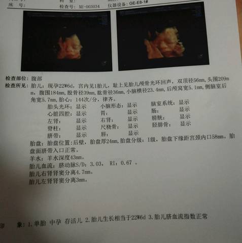 journal_insert_pic_1037221513
