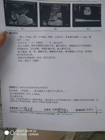 journal_insert_pic_1038118600