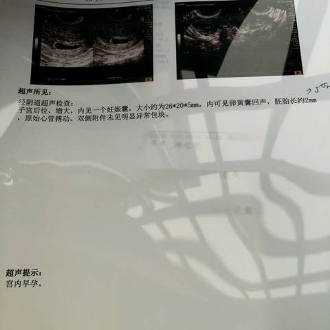 journal_insert_pic_1038097612
