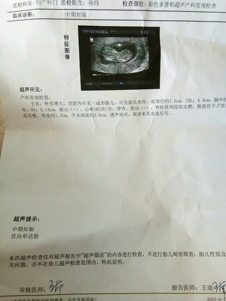 第一胎正常女孩！二胎男孩畸形！三胎要不要做羊水穿刺查染色体