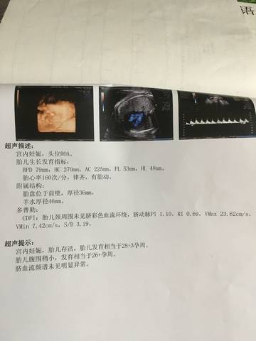 journal_insert_pic_1039545764