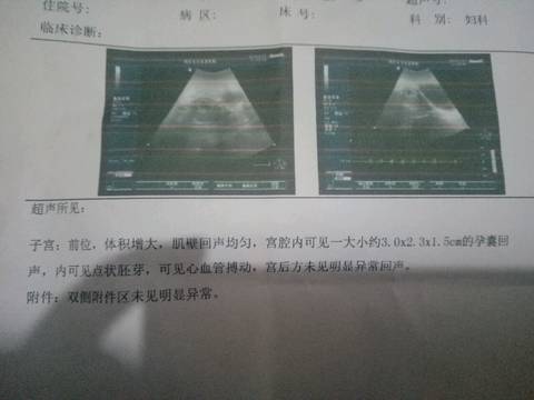 journal_insert_pic_1039267415