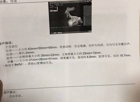 journal_insert_pic_1039139372