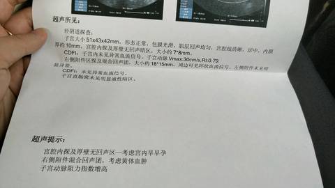 journal_insert_pic_1039509274