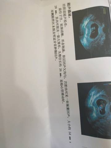 journal_insert_pic_1039814533