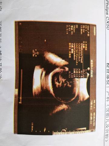 journal_insert_pic_1040005805