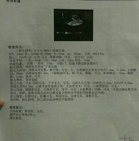 journal_insert_pic_1042004176
