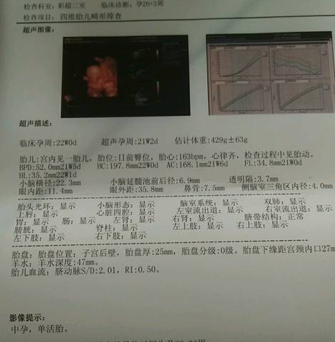 journal_insert_pic_1042248103