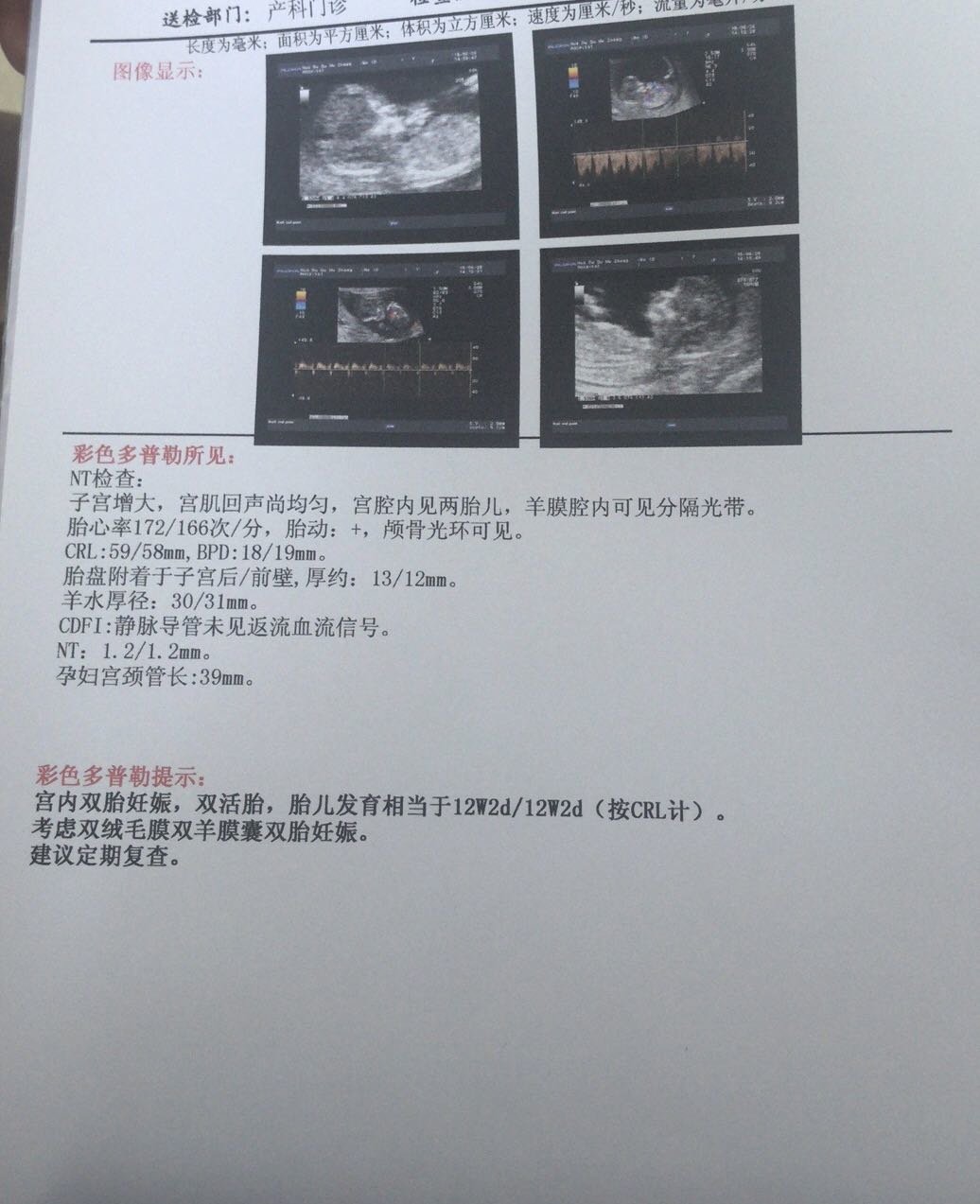 双胎NT通过