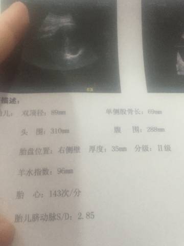 journal_insert_pic_1043654899