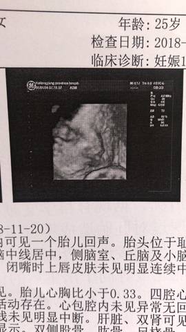 journal_insert_pic_1045015300