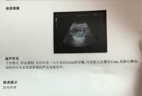 journal_insert_pic_1045429163