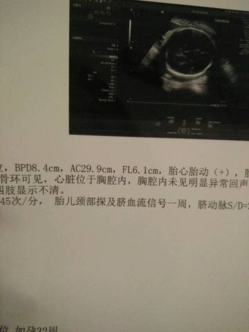 journal_insert_pic_1048399527