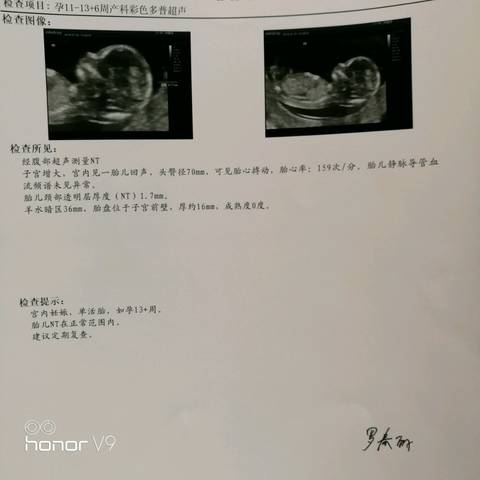 journal_insert_pic_1049017178