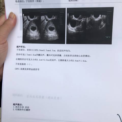 journal_insert_pic_1050265639