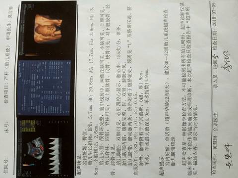 journal_insert_pic_1051621932