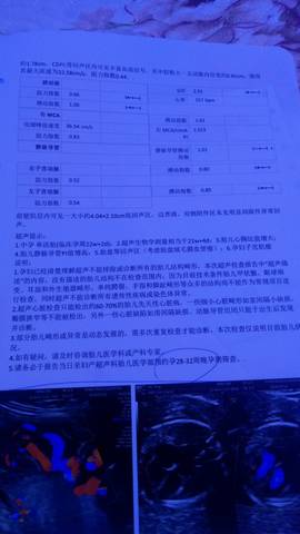 journal_insert_pic_1052555122