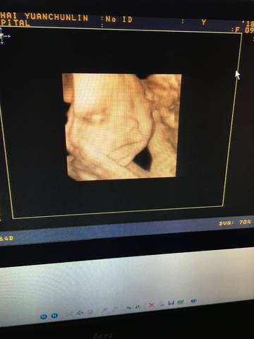 journal_insert_pic_1052923715