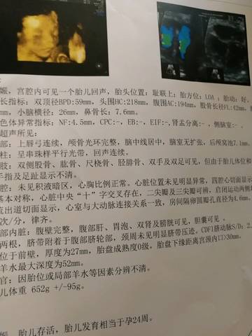 journal_insert_pic_1053055011
