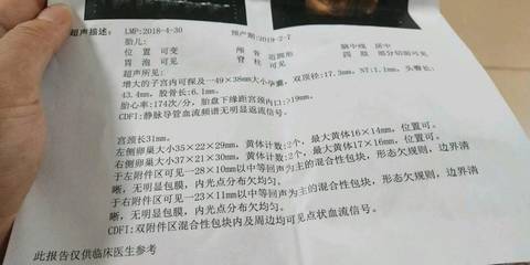 journal_insert_pic_1058126863