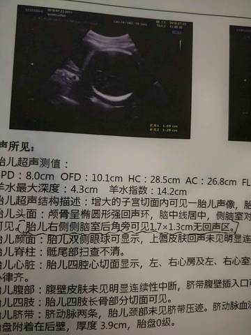 journal_insert_pic_1060350060