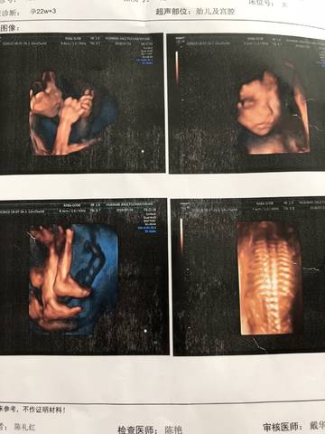 journal_insert_pic_1060443041