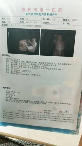 journal_insert_pic_1062031023