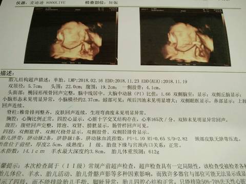 journal_insert_pic_1061764089