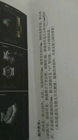 journal_insert_pic_1063584946
