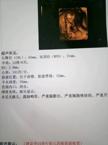 journal_insert_pic_1063997486
