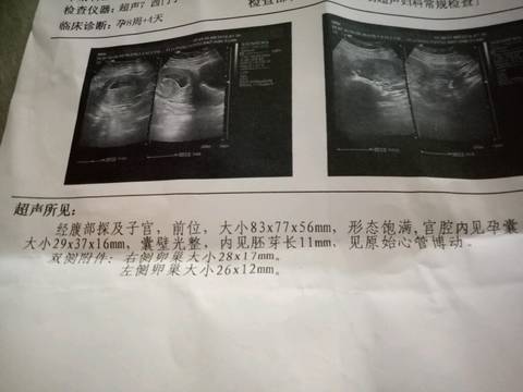 journal_insert_pic_1064291188