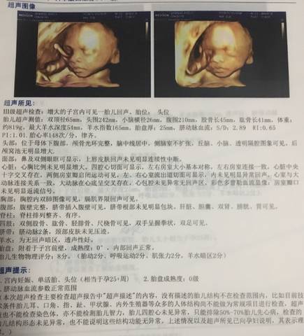journal_insert_pic_1064521327