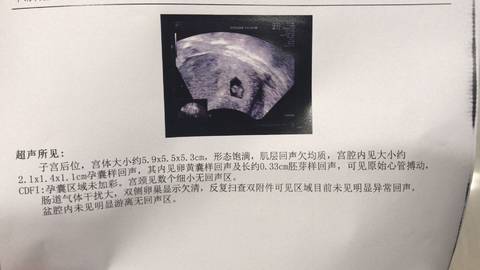 journal_insert_pic_1064832755