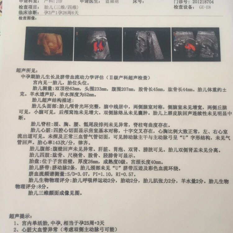 27周四维检查可能是双侧主动脉弓，怎么办？