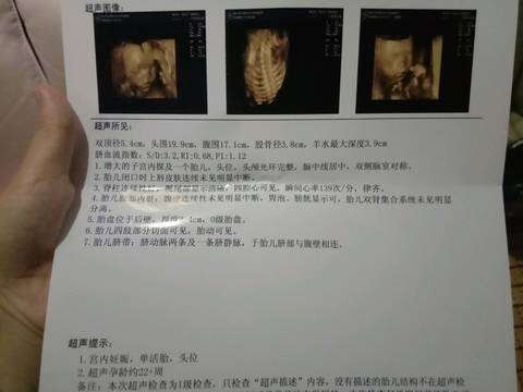 journal_insert_pic_1067041859