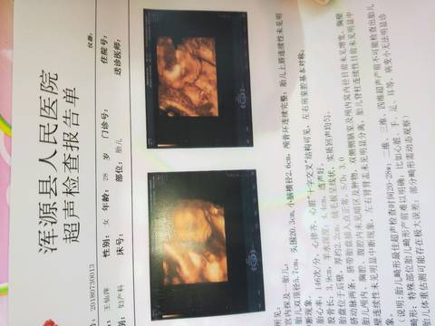 journal_insert_pic_1066943608