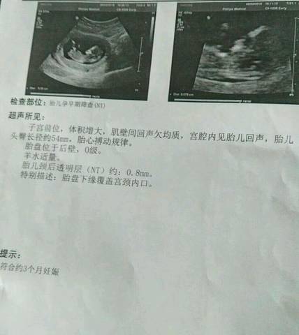 journal_insert_pic_1067157642