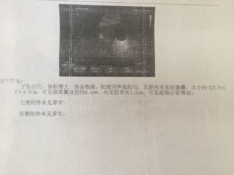 journal_insert_pic_1066763079